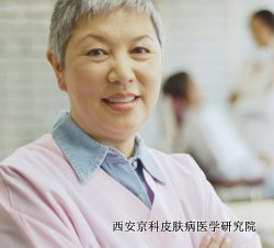 如何老年银屑病治疗好