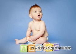 儿童银屑病具体病因